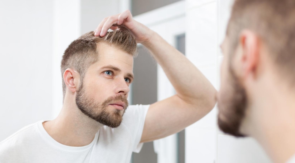handsome young man worried about hairloss